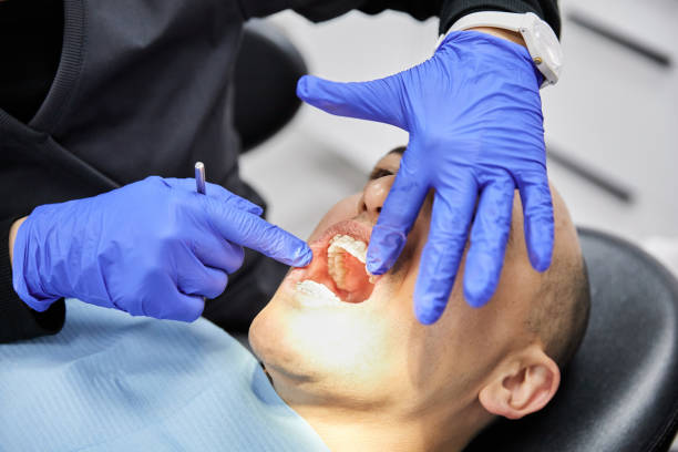 Best Emergency Broken Tooth Repair in Punta Rassa, FL